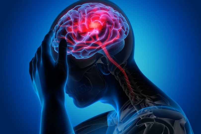 Brain Brain