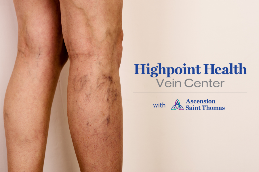 leg veins and Vein Center logo